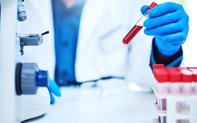 کاهش فزاینده ذخایر خونی خراسان رضوی کاهش فزاینده ذخایر خونی خراسان رضوی