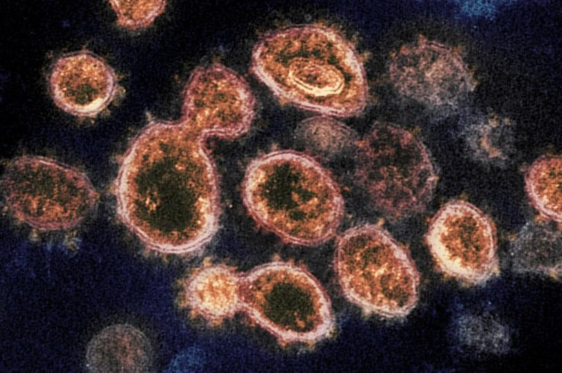 کشف روش از بین بردن ویروس کرونا طی 25 ثانیه!