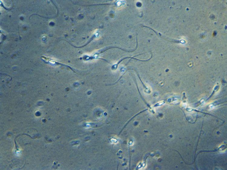 کشف یک خطای علمی پس از 340 سال؛ اسپرم شنا نمی کند، می چرخد