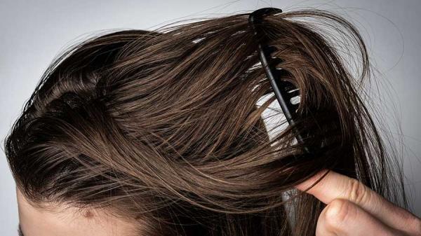 17 راهکار برای خلاص شدن از موی چرب
