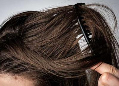 17 راهکار برای خلاص شدن از موی چرب